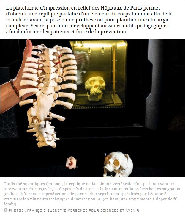 scienceetavenir - Hôpital : l'impression 3D pour une médecine de précision