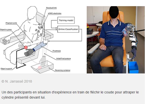 CNRS - Une prothèse de bras qui décode les mouvements du membre fantôme.jpg