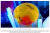 sciencepost - Identification un nouveau composé antibactérien d’une puissance exceptionnelle