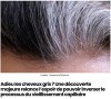 sciencepost - Une découverte relance l’espoir de pouvoir inverser le processus du vieillissement capillaire