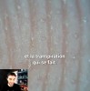 Dr Nozman - observer la transpiration au microscope