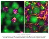 sciencepost - Des « mini-foies satellites » injectables : la folle promesse du MIT pour en finir avec la pénurie de greffons