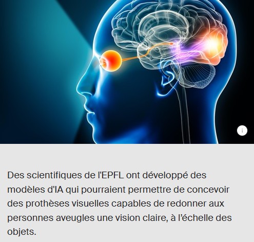 EPFL - Avec l'IA, les prothèses visuelles voient clairement les objets