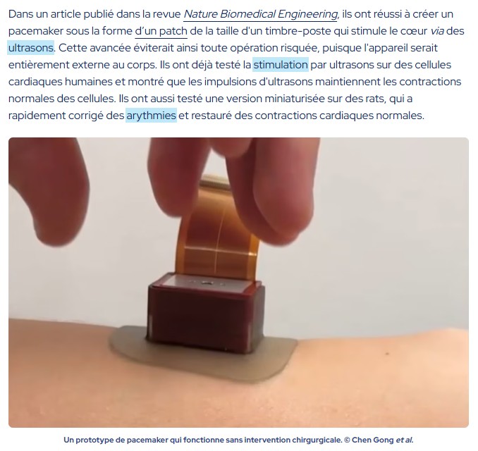 futura-sciences - Des chercheurs du MIT ont créé un pacemaker autocollant : sans implant, ni chirurgie
