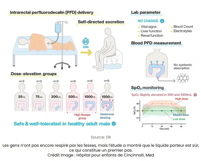 sciencepost - Des chercheurs japonais ont réussi à oxygéner du sang humain par voie rectale, et ce n’est pas une blague