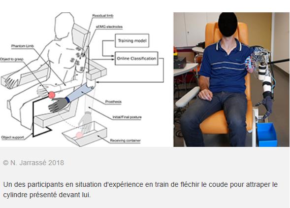CNRS - Une prothèse de bras qui décode les mouvements du membre fantôme.jpg