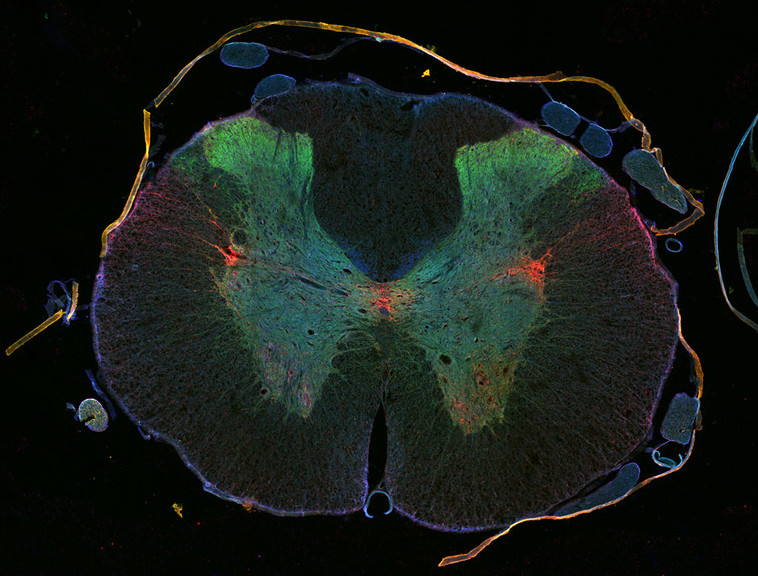 Cross_section_rat_spinal_cord.jpg