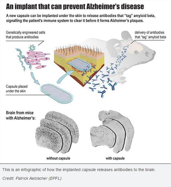 EPFL-umplantAntibodiesAlzheimer.jpg