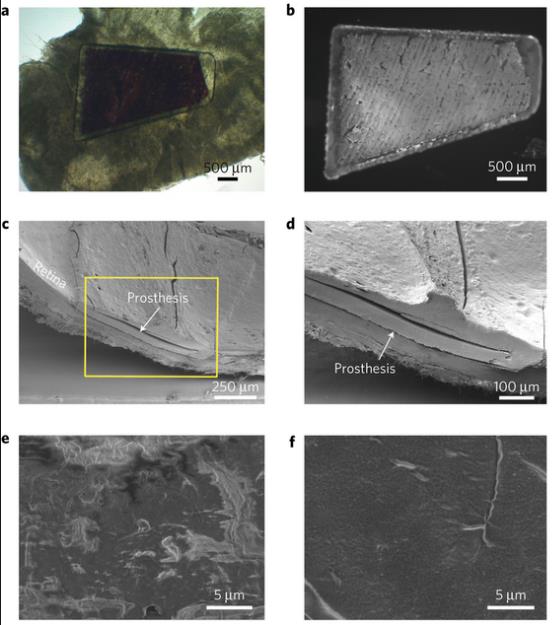 Implant_retinien_organique.jpg