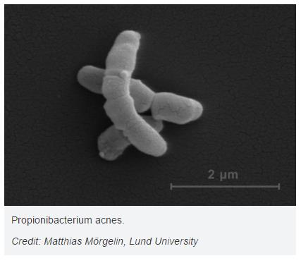 Propionibacterium_acnes.jpg