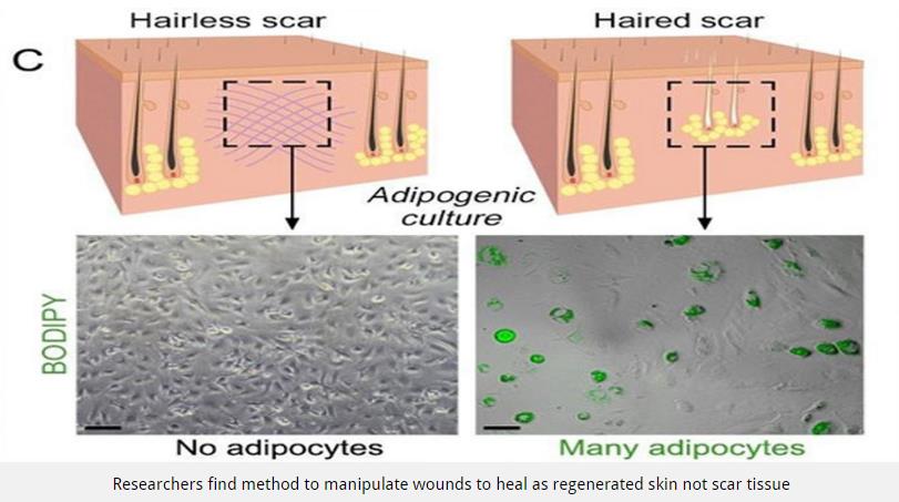 Skin-adipogenic_culture.jpg