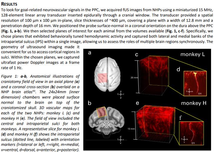 caltech.edu reading-minds-with-ultrasound-a-less-invasive-technique-to-decode-the-brains-intentions.jpg