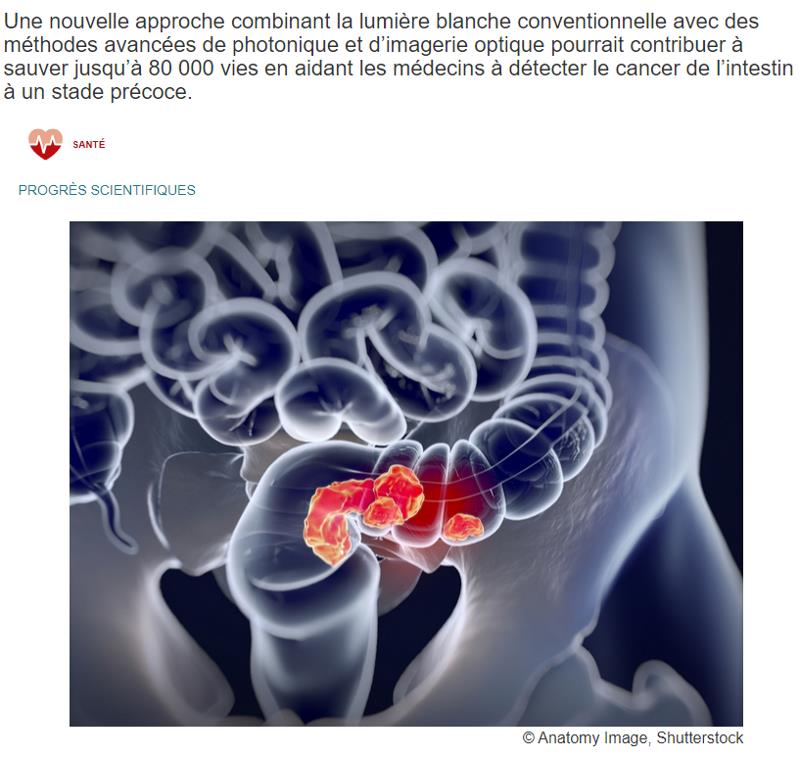 cordis.europa.eu spotting-colon-cancer-early-with-the-google-earth-of-colonoscopies.jpg