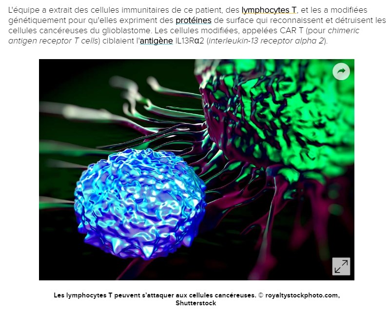 futura-sciences-Immunotherapie-cancer-cerveau.jpg