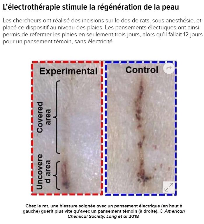 futura-sciences.com medecine-ce-pansement-electrique-accelere-cicatrisation.jpg