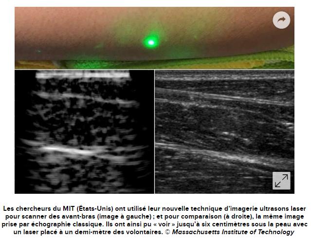 futura-sciences.com medecine-premiere-image-ultrasons-laser-distance-humain.jpg