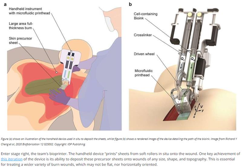 iflscience.com handheld-bioprinter-that-prints-skin-cells-onto-wounds-could-help-treat-serious-burns.jpg