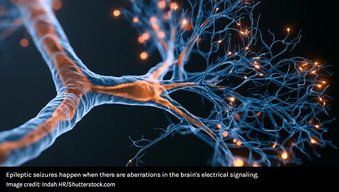 iflscience - Watch As A Seizure Speeds Through A Brain In Fascinating, First-Of-Its-Kind Video