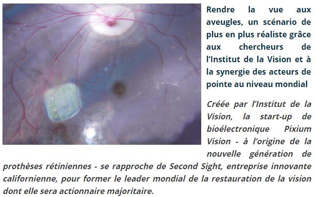 institut-vision.org - Rendre la vue aux aveugles, un scénario de plus en plus réaliste.jpg