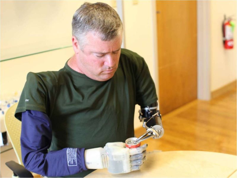 revolutionizing-prosthetics1.jpg