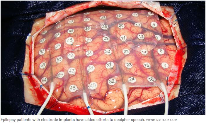 sciencemag.org artificial-intelligence-turns-brain-activity-speech.jpg