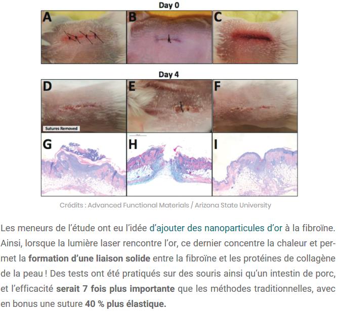 sciencepost.fr il-est-desormais-possible-de-guerir-une-blessure-grace-a-un-laser.jpg