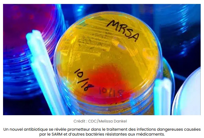 sciencepost - Identification un nouveau composé antibactérien d’une puissance exceptionnelle
