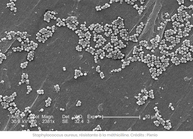 sciencepost.fr un-nouvel-espoir-inattendu-dans-la-lutte-contre-la-resistance-aux-antibiotiques.jpg