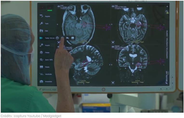 sciencepost.fr voici-la-premiere-prothese-a-neurones-pour-reactiver-les-souvenirs Prosthetic Memory System.jpg