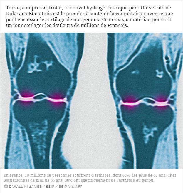 sciencesetavenir.fr arthrose-et-usure-du-genou-le-premier-hydrogel-aussi-resistant-que-le-vrai-cartilage.jpg