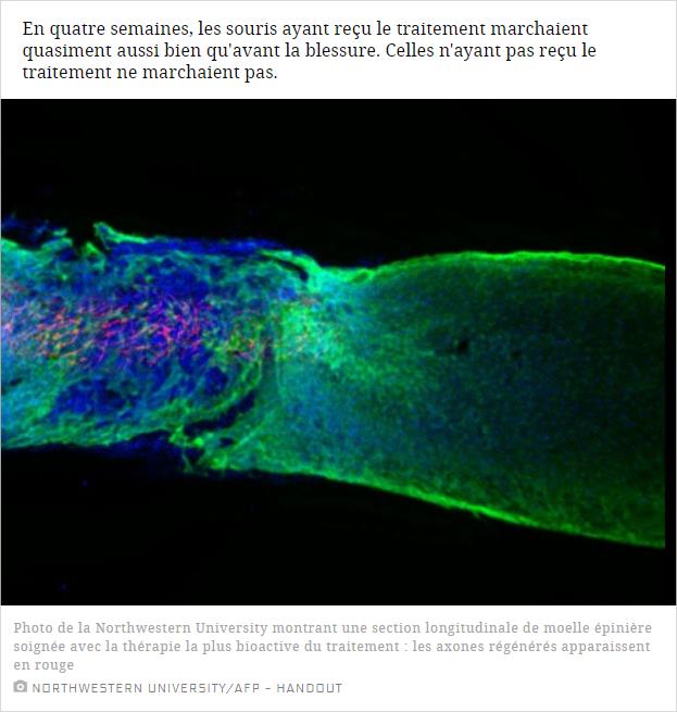 sciencesetavenir.fr un-medicament-evitant-la-paralysie-teste-sur-des-souris.jpg