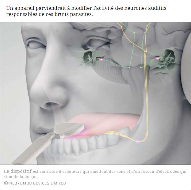 sciencesetavenir.fr un-traitement-prometteur-contre-les-acouphenes.jpg