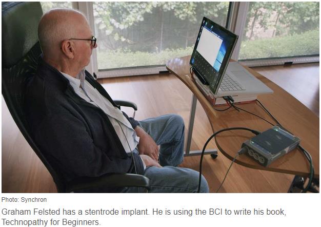 spectrum.ieee.org the-human-os biomedical bionics new-stent-like-electrode-allows-humans-to-operate-computers-with-their-thoughts.jpg