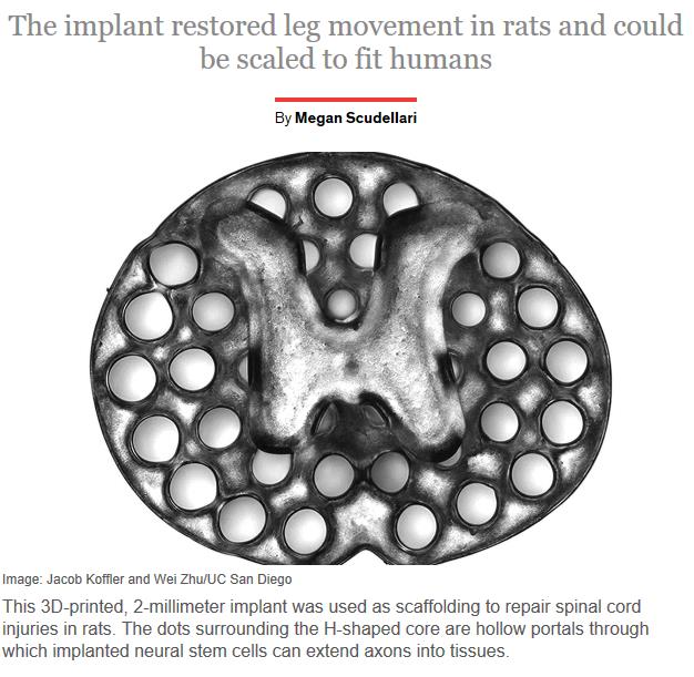 spectrum.ieee.org the-human-os biomedical devices this-3d-bioprinter-makes-a-spinal-cord-implant-in-16-seconds.jpg