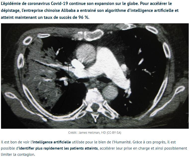 tomsguide.fr lintelligence-artificielle-dalibaba-detecte-96-des-infections-de-coronavirus.jpg