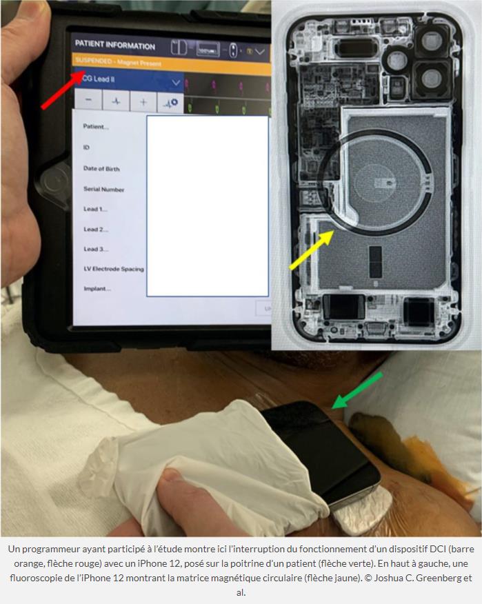 trustmyscience.com iphone-12-peut-arreter-stimulateur-cardiaque-en-etant-a-proximite.jpg