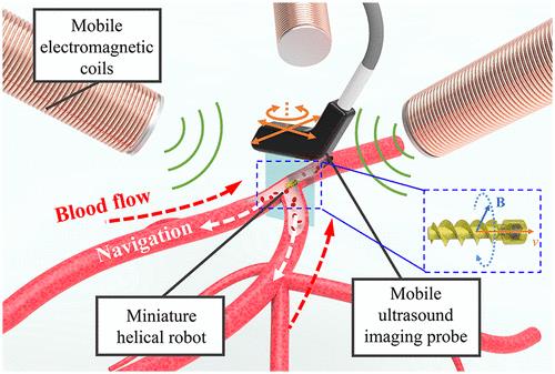 trustmyscience.com microrobot-helicoidal-nage-dans-vaisseaux-sanguins-pour-les-nettoyer.jpg