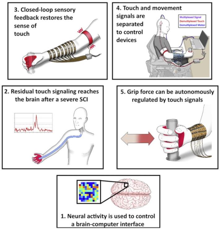 trustmyscience.com un-homme-retrouve-sens-du-toucher-grace-a-une-interface-cerveau-machine.jpg