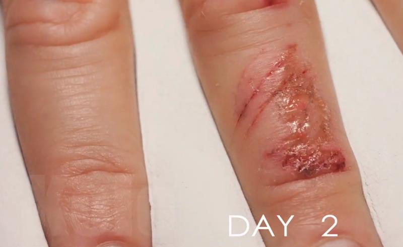 youtube.com Kolo - Time Lapse - Wound Healing Time Lapse.jpg